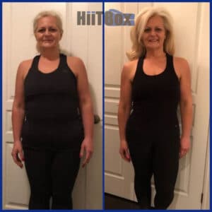 Linda A. Before and After