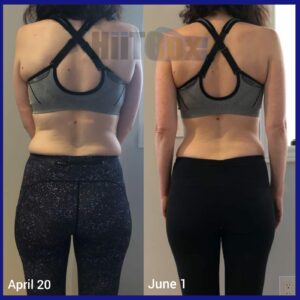Rosa R. Before and After Back